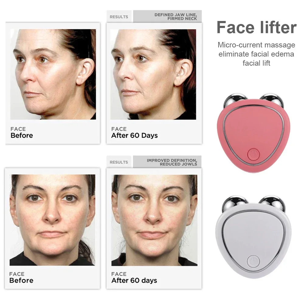 Electric EMS Facial Massager: Lifting Roller with Microcurrents and Gel to Firm and Rejuvenate the Skin - Image 2