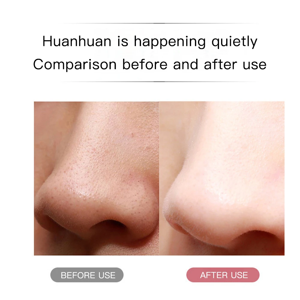 Electric Ultrasonic Skin Scrubber Vibration Face Spatula Peeling Blackhead Remover Facial Lifting Cleansing Ultrasonic Skin Care Electric Ultrasonic Skin Scrubber Vibration Face Spatula Peeling Blackhead Remover Facial Lifting Cleansing Ultrasonic Skin Care