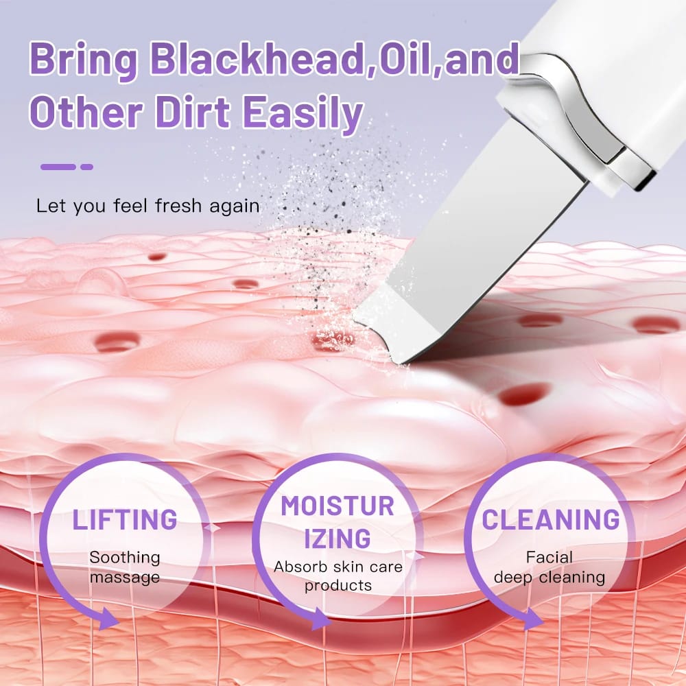 Electric Ultrasonic Facial Massager: Deep Cleansing, Blackhead Removal and Facial Lifting - Image 3